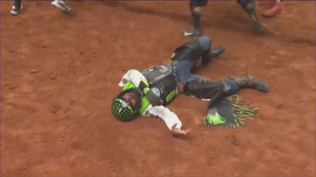Did Jose Vitor Leme Lose His Hand?