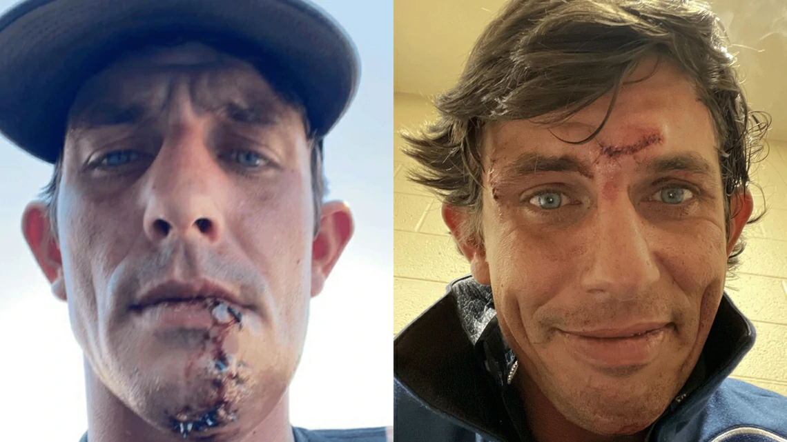 What Ended JB Mauney Career?